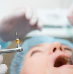 A dental implant surgery procedure