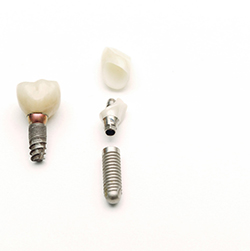 Different dental implant parts have different costs depending on the size, brand, and materials