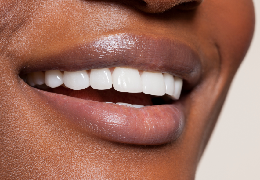Close up of woman's smile